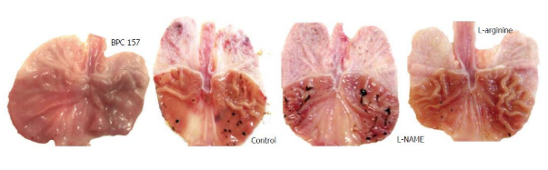 bpc157 drugs